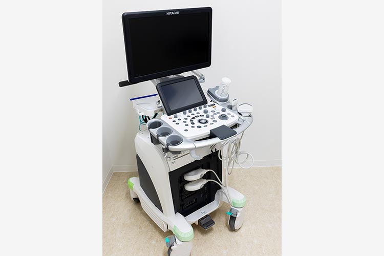 超音波診断装置